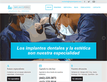 Tablet Screenshot of implantoperio.com
